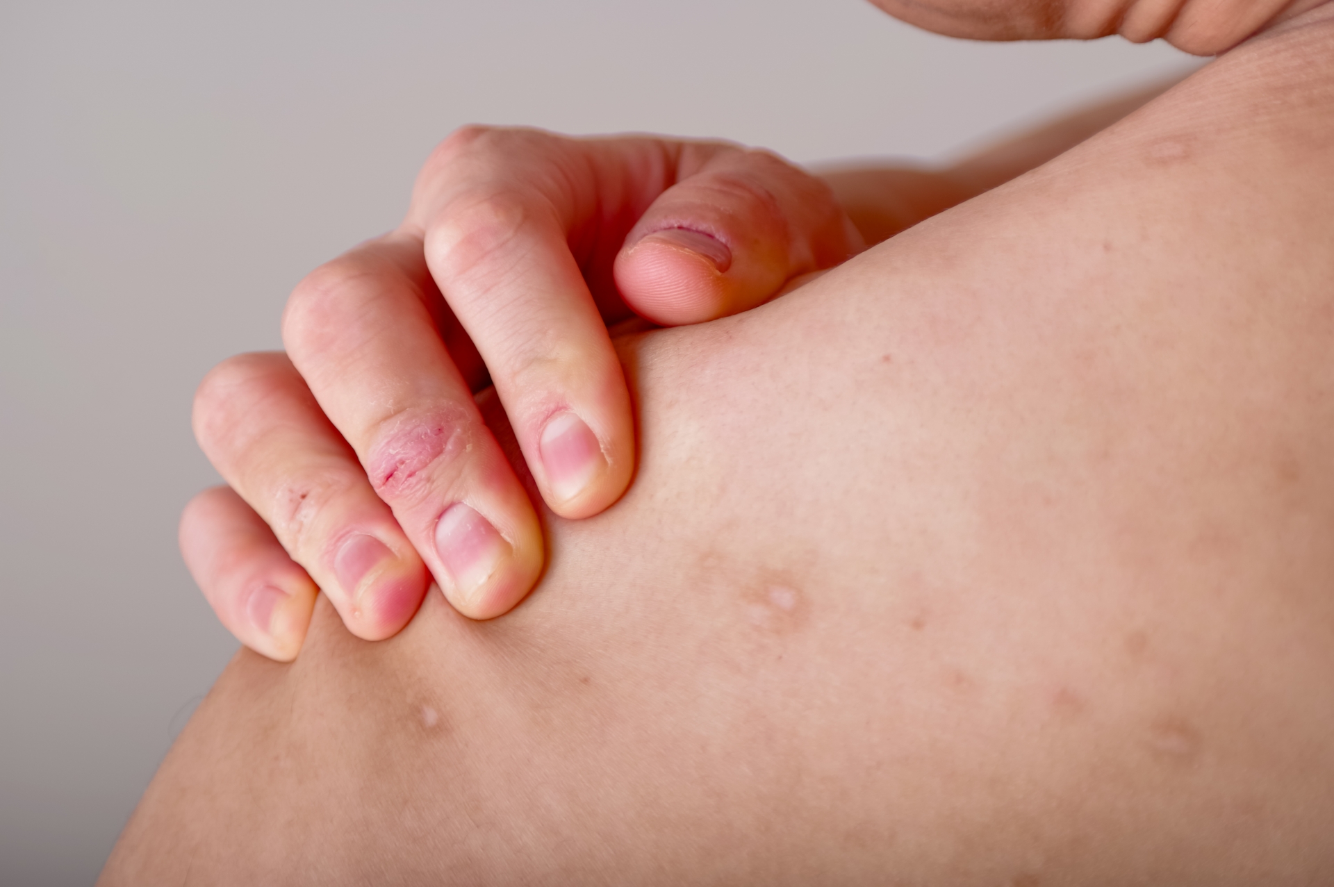 Image hover effect image